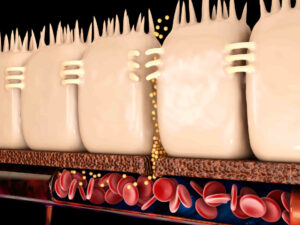 Leaky gut causes